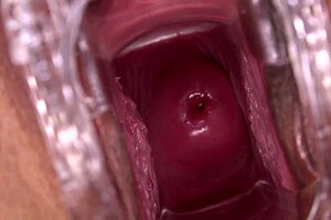 mia austin undergoes close-up speculum examination