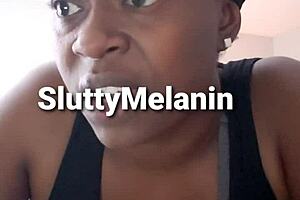 I got a yest infection on my penus and it hurts so bad