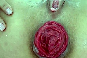 Watch the destroyed anal prolapse up close in this extreme play.