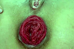 极端玩法特写毁坏肛门脱垂