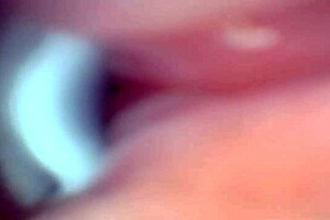Wow! Endoscope Camera Captures Huge Cock Ejaculation Moment In Pov!