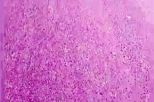 Venezuelan woman spotted out on the street